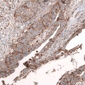 Monoclonal Anti-Igfbp2 Antibody Produced In Mouse Prestige Antibodies® Powered by Atlas Antibodies, clone CL13565, affinity isolated antibody, buffered aqueous glycerol solution