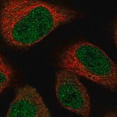 Anti-TADA3 antibody produced in rabbit Prestige Antibodies® Powered by Atlas Antibodies, affinity isolated antibody, buffered aqueous glycerol solution