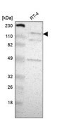 抗-CECR2 兔抗 Prestige Antibodies® Powered by Atlas Antibodies, affinity isolated antibody, buffered aqueous glycerol solution