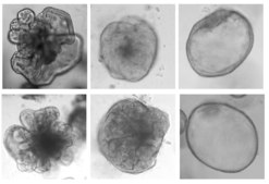 3dGRO® Human iPSC Derived Liver Organoid Progenitors Normal, Dermal Fibroblast, Age: Neonatal, Male, Mutation: None