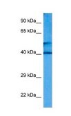 Anti-CKM (ab2) antibody produced in rabbit affinity isolated antibody