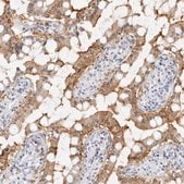 Anti-SLC9A3R1 antibody produced in rabbit Prestige Antibodies® Powered by Atlas Antibodies, affinity isolated antibody, buffered aqueous glycerol solution