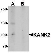 Anti-KANK2 antibody produced in rabbit affinity isolated antibody, buffered aqueous solution