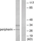 抗-PGP9.5 兔抗 affinity isolated antibody