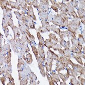 Anti-Prohibitin antibody produced in rabbit