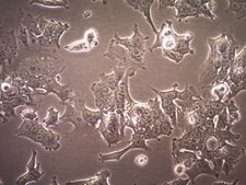 CWR-R1ca Human Prostate Cancer Cell Line CWR-R1ca Human Prostate Cancer Cell Line is a valuable cell model for castration-recurrent prostate cancer studies.