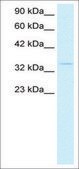 Anti-HEY1 antibody produced in rabbit IgG fraction of antiserum