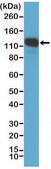 Anti-CD146 antibody, Rabbit monoclonal recombinant, expressed in HEK 293 cells, clone RM249, purified immunoglobulin