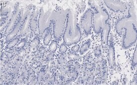 Anti-MYO1C Antibody, clone 4B19, ZooMAb® Rabbit Monoclonal recombinant, expressed in HEK 293 cells