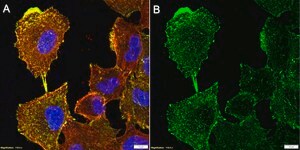 Anti-α-Actinin 4 Antibody, clone 1D9 ZooMAb® Rabbit Monoclonal recombinant, expressed in HEK 293 cells