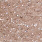 Anti-RYR2 antibody produced in rabbit Prestige Antibodies® Powered by Atlas Antibodies, affinity isolated antibody, buffered aqueous glycerol solution