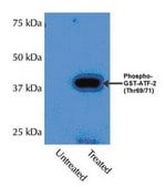 SAPK Pathway Explorer Antibody Minipack Upstate®