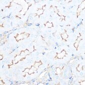 Anti-SSTR5 antibody produced in rabbit