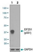 Monoclonal Anti-EIF2S1 (phospho S51) antibody produced in rabbit clone IO-5