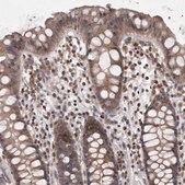 Anti-PCM1 antibody produced in rabbit Prestige Antibodies® Powered by Atlas Antibodies, affinity isolated antibody, buffered aqueous glycerol solution, Ab2