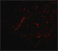 Anti-Nhe-1 (ab1) antibody produced in rabbit affinity isolated antibody, buffered aqueous solution