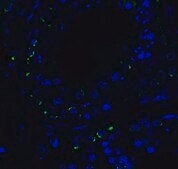 Anti-RIG-1 antibody produced in rabbit purified antibody (DEAE)
