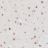 Anti-SMARCA2 antibody produced in rabbit Prestige Antibodies® Powered by Atlas Antibodies, affinity isolated antibody, buffered aqueous glycerol solution