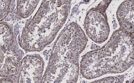 Anti-Pericentrin Antibody, clone 2H11, ZooMAb® Rabbit Monoclonal recombinant, expressed in HEK 293 cells