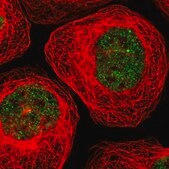 Anti-TARDBP antibody produced in rabbit affinity isolated antibody, buffered aqueous glycerol solution