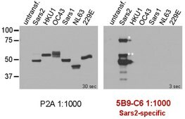 Anti-SARS-CoV-2 nucleocapsid Antibody, clone 5B9-C6