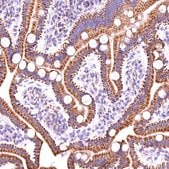 Anti-ACAA2 antibody produced in rabbit Prestige Antibodies® Powered by Atlas Antibodies, affinity isolated antibody, buffered aqueous glycerol solution