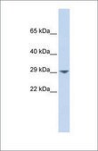 Anti-KCNN2 antibody produced in rabbit affinity isolated antibody