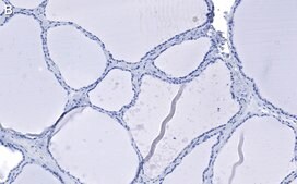 Anti-Bcl-2 Antibody, clone 1K8 ZooMAb® Rabbit Monoclonal recombinant, expressed in HEK 293 cells