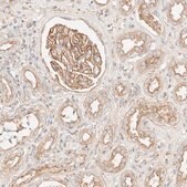 Anti-MYO10 antibody produced in rabbit Prestige Antibodies® Powered by Atlas Antibodies, affinity isolated antibody, buffered aqueous glycerol solution