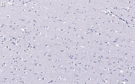 Anti-EEA1 Antibody, clone 1H18 ZooMAb® Rabbit Monoclonal recombinant, expressed in HEK 293 cells