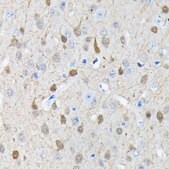 Anti-PGP9.5/UCHL1 antibody produced in rabbit