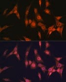 Anti-PAK2 Antibody, clone 2Y7I2, Rabbit Monoclonal