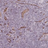 Anti-CD34 antibody produced in rabbit Prestige Antibodies® Powered by Atlas Antibodies, affinity isolated antibody, buffered aqueous glycerol solution