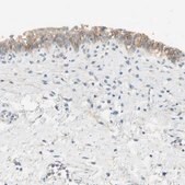 抗-NECTIN4 兔抗 Prestige Antibodies® Powered by Atlas Antibodies, affinity isolated antibody, buffered aqueous glycerol solution