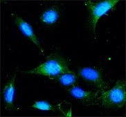 抗LAMP2 兔抗 affinity isolated antibody, buffered aqueous solution