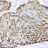 Anti-MUC1 antibody produced in rabbit