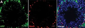 Anti-Sox9 Antibody Chemicon®, from rabbit
