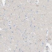 Anti-DUOX1 antibody produced in rabbit Prestige Antibodies® Powered by Atlas Antibodies, affinity isolated antibody, buffered aqueous glycerol solution