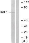 Anti-C-RAF, C-Terminal antibody produced in rabbit affinity isolated antibody