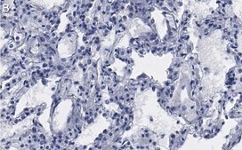 Anti-CD54 Antibody, clone 2C15 ZooMAb® Rabbit Monoclonal recombinant, expressed in HEK 293 cells