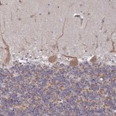 Anti-DVL3 antibody produced in rabbit Prestige Antibodies® Powered by Atlas Antibodies, affinity isolated antibody, buffered aqueous glycerol solution