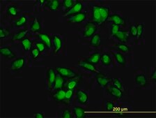 Monoclonal Anti-EIF2AK2 antibody produced in mouse clone 1B9, purified immunoglobulin, buffered aqueous solution