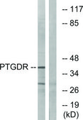 Anti-PTGDR antibody produced in rabbit affinity isolated antibody