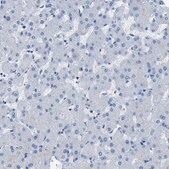 Anti-ITPR1 antibody produced in rabbit Prestige Antibodies® Powered by Atlas Antibodies, affinity isolated antibody, buffered aqueous glycerol solution