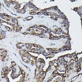 Anti- Calreticulin antibody produced in rabbit