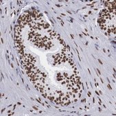 Anti-MECP2 antibody produced in rabbit Ab1, Prestige Antibodies® Powered by Atlas Antibodies, affinity isolated antibody, buffered aqueous glycerol solution