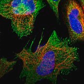 Anti-RAPSN antibody produced in rabbit Prestige Antibodies® Powered by Atlas Antibodies, affinity isolated antibody, buffered aqueous glycerol solution