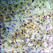 Anti-phospho-NMDAR2B (pTyr1336) antibody produced in rabbit affinity isolated antibody