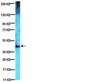 Anti-Spinocerebellar Ataxia Type 3 Antibody, clone 1H9 ascites fluid, clone 1H9, Chemicon®