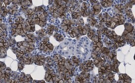 Anti-Aquaporin 5 Antibody, clone 3H17 ZooMAb® Rabbit Monoclonal recombinant, expressed in HEK 293 cells